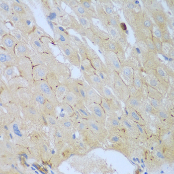 Immunohistochemistry - CEACAM7 Polyclonal Antibody 
