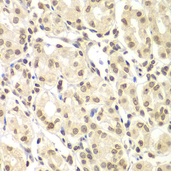 Immunohistochemistry - ULK4 Polyclonal Antibody 
