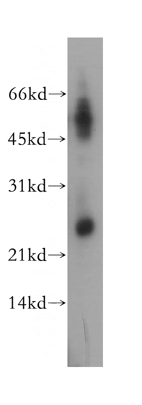 mouse uterus tissue were subjected to SDS PAGE followed by western blot with Catalog No:110118(DUSP19 antibody) at dilution of 1:300