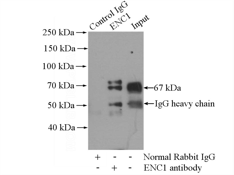 IP Result of anti-ENC1 (IP:Catalog No:110246, 4ug; Detection:Catalog No:110246 1:1000) with mouse brain tissue lysate 2640ug.