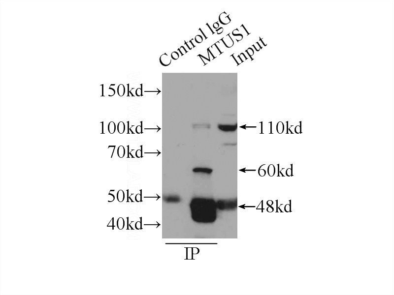 IP Result of anti-MTUS1 (IP:Catalog No:112883, 4ug; Detection:Catalog No:112883 1:500) with mouse brain tissue lysate 6000ug.