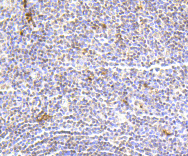 Immunohistochemistry - Hydroxyl-Histone H2A-Y39 Monoclonal Antibody 
