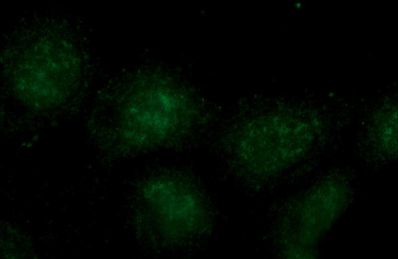 Immunofluorescent analysis of A431 cells using Catalog No:107544(WTAP Antibody) at dilution of 1:50 and Alexa Fluor 488-congugated AffiniPure Goat Anti-Mouse IgG(H+L)