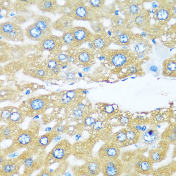Immunohistochemistry - ARHGEF5 Polyclonal Antibody 