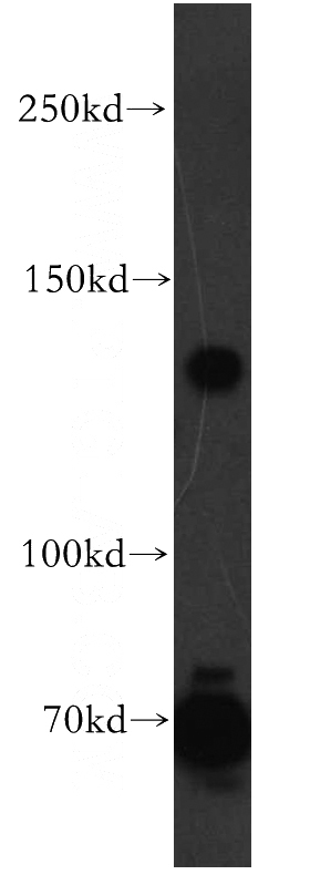 human brain tissue were subjected to SDS PAGE followed by western blot with Catalog No:108263(ARHGAP20 antibody) at dilution of 1:500