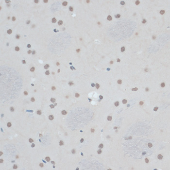 Immunohistochemistry - ZNF433 Polyclonal Antibody 
