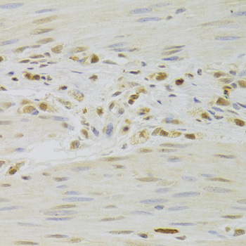 Immunohistochemistry - PRPF3 Polyclonal Antibody 