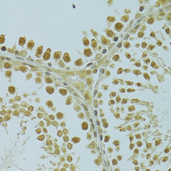 Immunohistochemistry - RSRC1 Polyclonal Antibody 