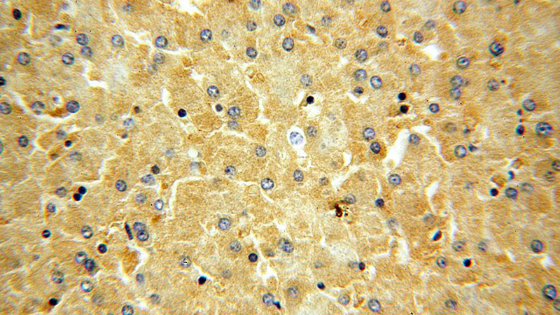 Immunohistochemical of paraffin-embedded human liver using Catalog No:113458(OAS1 antibody) at dilution of 1:100 (under 40x lens)