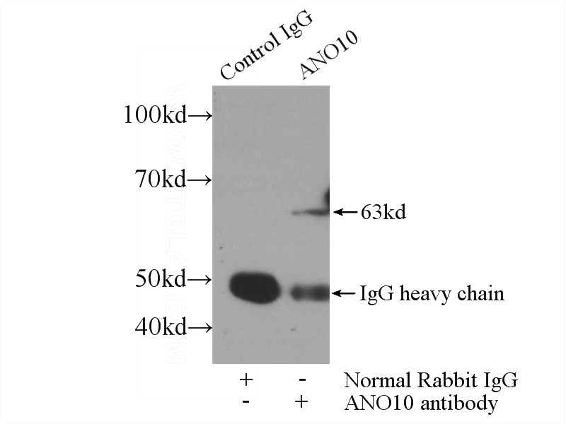 IP Result of anti-ANO10 (IP:Catalog No:108100, 3ug; Detection:Catalog No:108100 1:500) with mouse brain tissue lysate 3600ug.