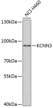 Western blot - KCNN3 Polyclonal Antibody 