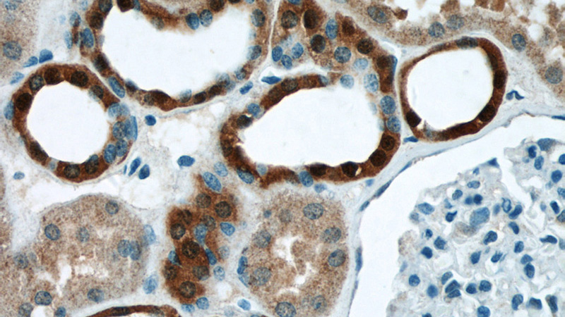 Immunohistochemistry of paraffin-embedded human kidney tissue slide using Catalog No:116764(VMO1 Antibody) at dilution of 1:50 (under 40x lens)