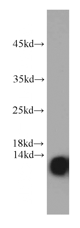 HeLa cells were subjected to SDS PAGE followed by western blot with Catalog No:107325(NDUFA4L2 antibody) at dilution of 1:1000