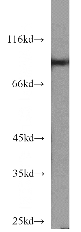 HeLa cells were subjected to SDS PAGE followed by western blot with Catalog No:115694(STAT5B antibody) at dilution of 1:1000