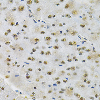 Immunohistochemistry - OTX2 Polyclonal Antibody 