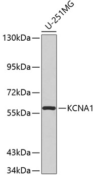 Western blot - KCNA1 Polyclonal Antibody 