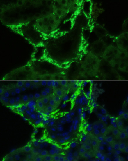 Immunofluorescence - COL1A1 Polyclonal Antibody 