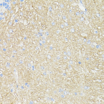 Immunohistochemistry - THY1 Polyclonal Antibody 