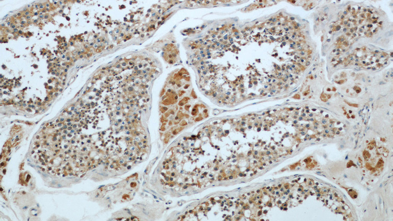 Immunohistochemical of paraffin-embedded human testis using Catalog No:116847(WBP2 antibody) at dilution of 1:50 (under 10x lens)