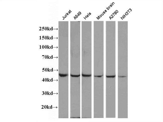 WB result of anti-LPAR1 (Catalog No:,1:1,000).