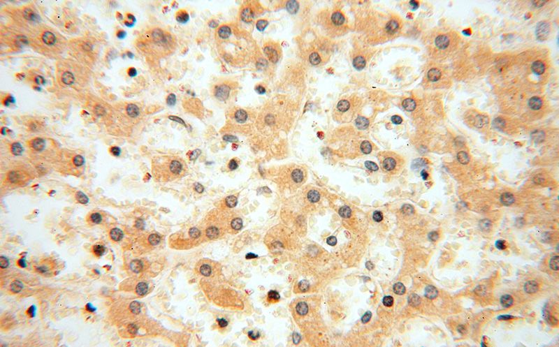 Immunohistochemical of paraffin-embedded human liver using Catalog No:112810(MRPL11 antibody) at dilution of 1:50 (under 40x lens)
