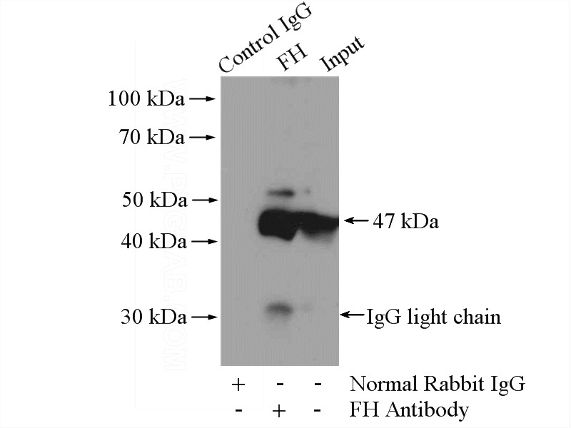 IP Result of anti-FH (IP:Catalog No:110646, 4ug; Detection:Catalog No:110646 1:1000) with HepG2 cells lysate 2400ug.