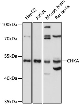 Western blot - CHKA Polyclonal Antibody 