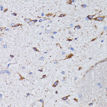 Immunohistochemistry - AVP Polyclonal Antibody 