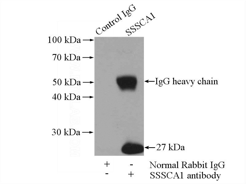 IP Result of anti-SSSCA1 (IP:Catalog No:115611, 4ug; Detection:Catalog No:115611 1:1000) with HeLa cells lysate 2000ug.