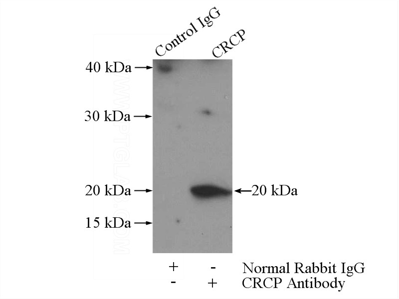 IP Result of anti-CRCP (IP:Catalog No:109540, 3ug; Detection:Catalog No:109540 1:1000) with Raji cells lysate 2800ug.