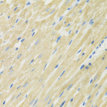 Immunohistochemistry - SLC19A1 Polyclonal Antibody 