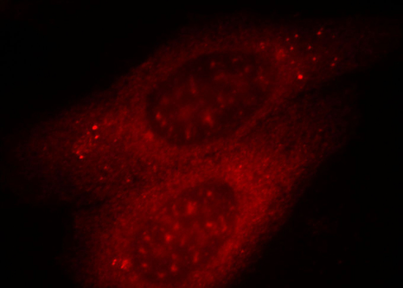 Immunofluorescent analysis of HepG2 cells, using ANO2 antibody Catalog No:108101 at 1:25 dilution and Rhodamine-labeled goat anti-rabbit IgG (red).