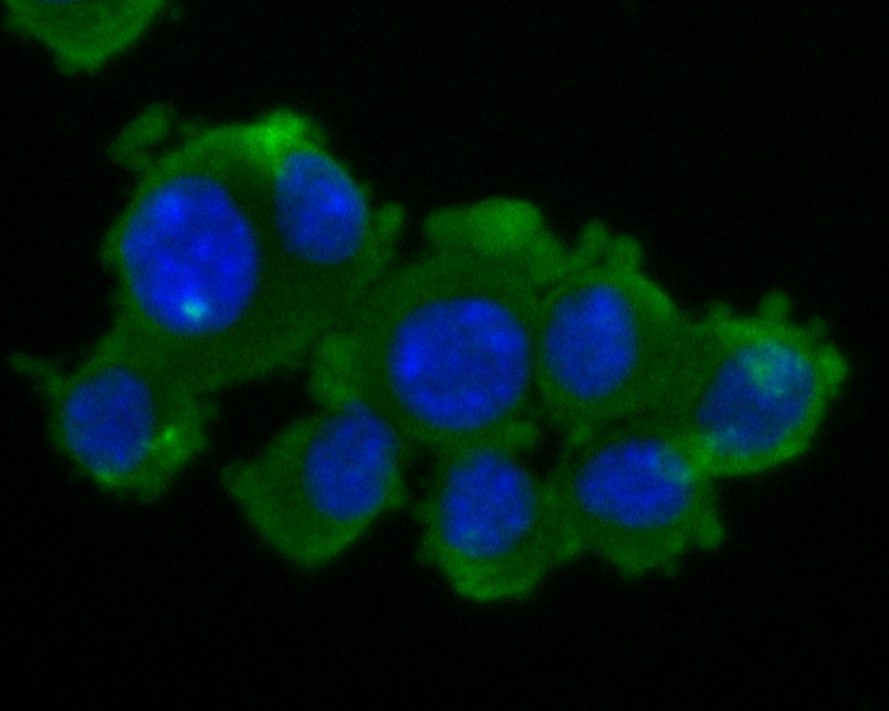 Fig2: ICC staining of ZAC in N2A cells (green). Formalin fixed cells were permeabilized with 0.1% Triton X-100 in TBS for 10 minutes at room temperature and blocked with 1% Blocker BSA for 15 minutes at room temperature. Cells were probed with the primary antibody ( 1/200) for 1 hour at room temperature, washed with PBS. Alexa Fluor®488 Goat anti-Rabbit IgG was used as the secondary antibody at 1/1,000 dilution. The nuclear counter stain is DAPI (blue).
