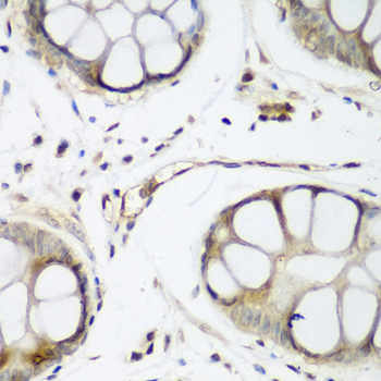 Immunohistochemistry - TAZ Polyclonal Antibody 