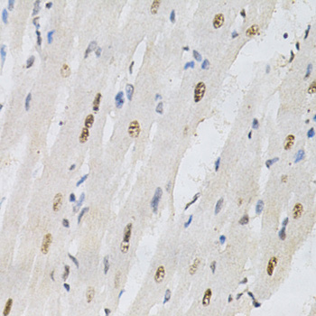 Immunohistochemistry - KPNA4 Polyclonal Antibody 