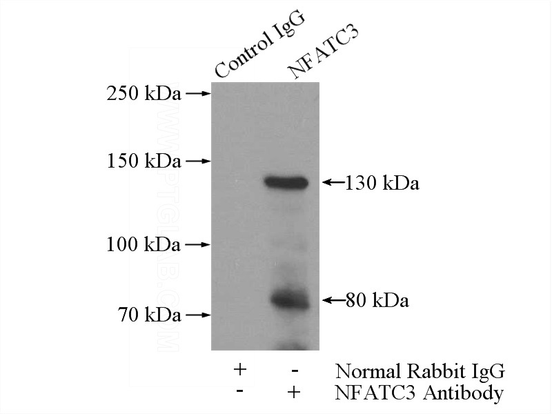 IP Result of anti-NFATC3 (IP:Catalog No:113143, 5ug; Detection:Catalog No:113143 1:500) with mouse skeletal muscle tissue lysate 2000ug.