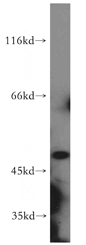 mouse lung tissue were subjected to SDS PAGE followed by western blot with Catalog No:110386(EFNB1 antibody) at dilution of 1:300