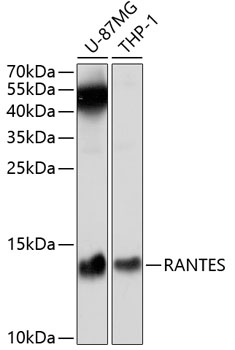 Western blot - RANTES Polyclonal Antibody 