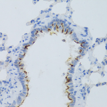 Immunohistochemistry - PTGER2 Polyclonal Antibody 