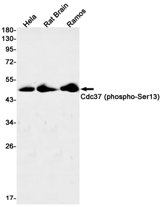 Western blot detection of Cdc37 (phospho-Ser13) in Hela,Rat Brain,Ramos cell lysates using Cdc37 (phospho-Ser13) Rabbit mAb(1:1000 diluted).Predicted band size:45kDa.Observed band size:45kDa.