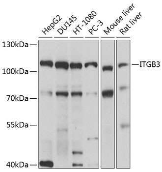 Western blot - ITGB3 Polyclonal Antibody 