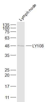 Fig1: Sample:; Lymph node (Mouse) Lysate at 40 ug; Primary: Anti-LY108 at 1/1000 dilution; Secondary: IRDye800CW Goat Anti-Rabbit IgG at 1/20000 dilution; Predicted band size: 37 kD; Observed band size: 48 kD