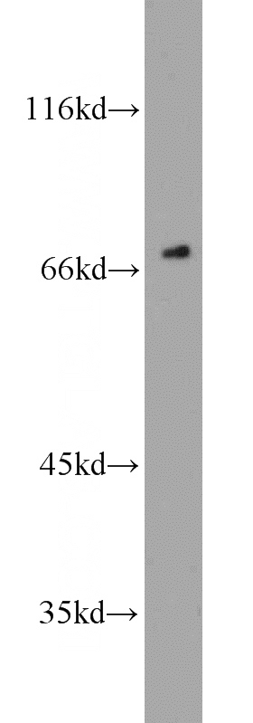 K-562 cells were subjected to SDS PAGE followed by western blot with Catalog No:111557(HSF1 antibody) at dilution of 1:1000