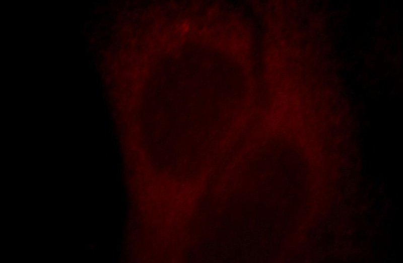 Immunofluorescent analysis of HepG2 cells, using KCNJ8 antibody Catalog No:112066 at 1:25 dilution and Rhodamine-labeled goat anti-rabbit IgG (red).