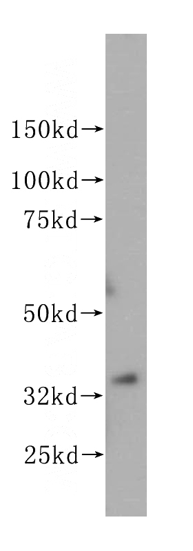 human heart tissue were subjected to SDS PAGE followed by western blot with Catalog No:113729(PEX19 antibody) at dilution of 1:300