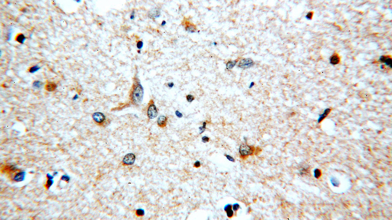 Immunohistochemical of paraffin-embedded human brain using Catalog No:112073(KLC1 antibody) at dilution of 1:100 (under 40x lens)