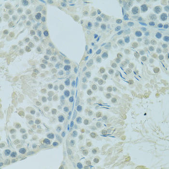 Immunohistochemistry - PSIP1 Polyclonal Antibody 