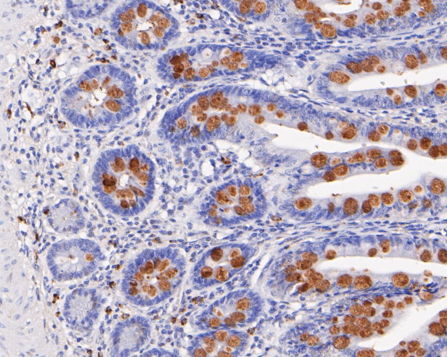 Fig6:; Immunohistochemical analysis of paraffin-embedded human small intestine tissue using anti-MUC2 antibody. The section was pre-treated using heat mediated antigen retrieval with Tris-EDTA buffer (pH 9.0) for 20 minutes.The tissues were blocked in 5% BSA for 30 minutes at room temperature, washed with ddH; 2; O and PBS, and then probed with the primary antibody ( 1/200) for 30 minutes at room temperature. The detection was performed using an HRP conjugated compact polymer system. DAB was used as the chromogen. Tissues were counterstained with hematoxylin and mounted with DPX.
