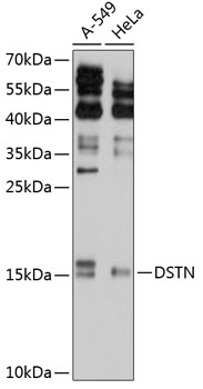 Western blot - DSTN Polyclonal Antibody 