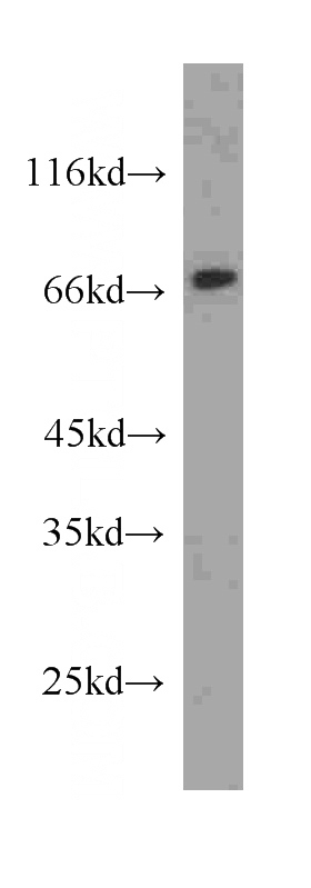 rat pancreas tissue were subjected to SDS PAGE followed by western blot with Catalog No:107157(CHGA antibody) at dilution of 1:1000